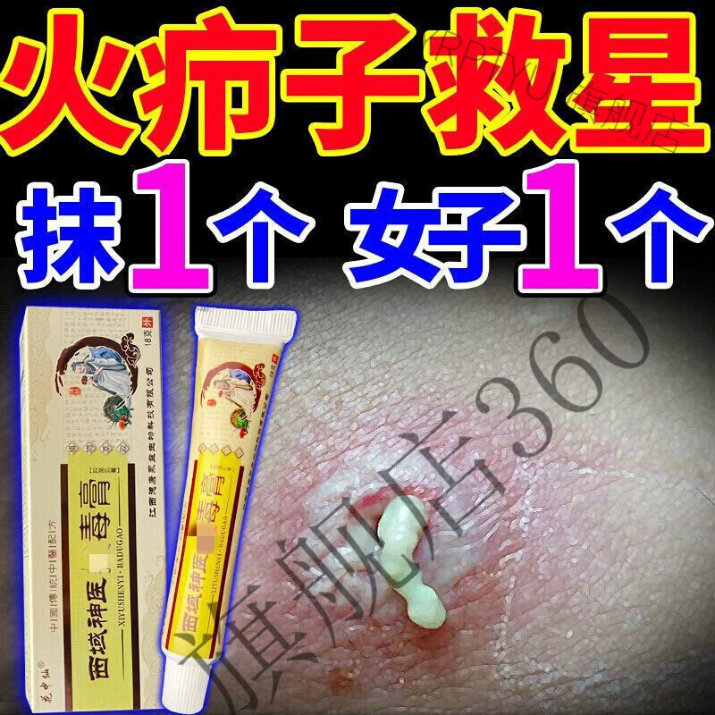 火疖子拔i毒膏【一抹即除】拔i毒拨垠拔脓红肿脓包火疙瘩脖子皮肤下巴