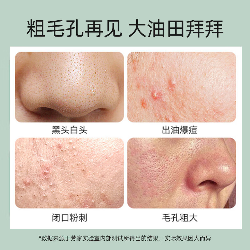 【毛孔粗大救星】排出脏东西 比荷荷巴油好用 第三代果酸收缩毛孔精华液水男女 乳糖酸精华水【拍2到手3瓶】