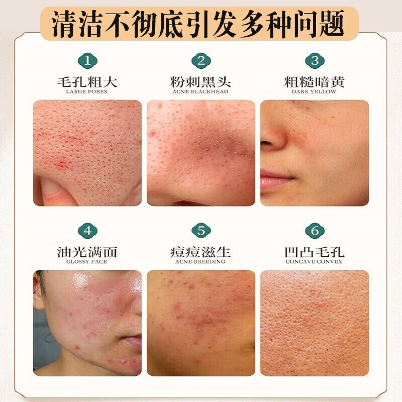 南京同仁堂去黑头撕拉面膜去吸鼻贴男女通用收缩毛孔深层清洁面膜祛粉刺死皮鼻80g 一瓶装80g大容量【针对毛孔黑头见效装】