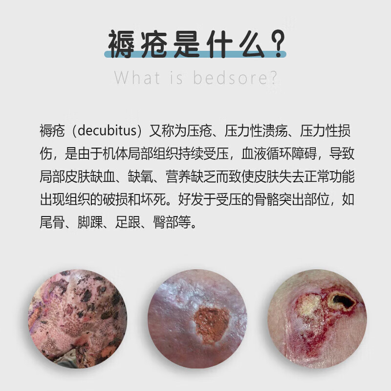 褥疮膏褥疮型皮肤溃烂老人长期卧床伤口愈合灼伤老人专用膏贴药 单盒