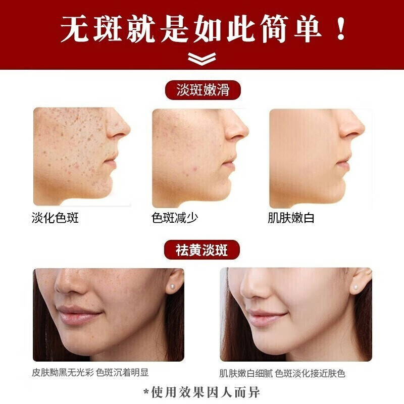 白云山星群 丽康源烟酰胺美白精华液 去斑淡化斑点黑色素雀斑晒斑老年斑美白祛斑精华原液 美白精华液 1瓶/20ml