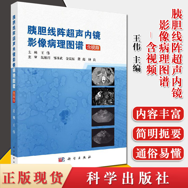 胰胆线阵超声内镜影像病理图谱-含视频 王伟主编 胰腺囊病变 胆总管