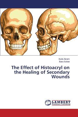 预订The Effect of Histoacryl on the Healing of Secon