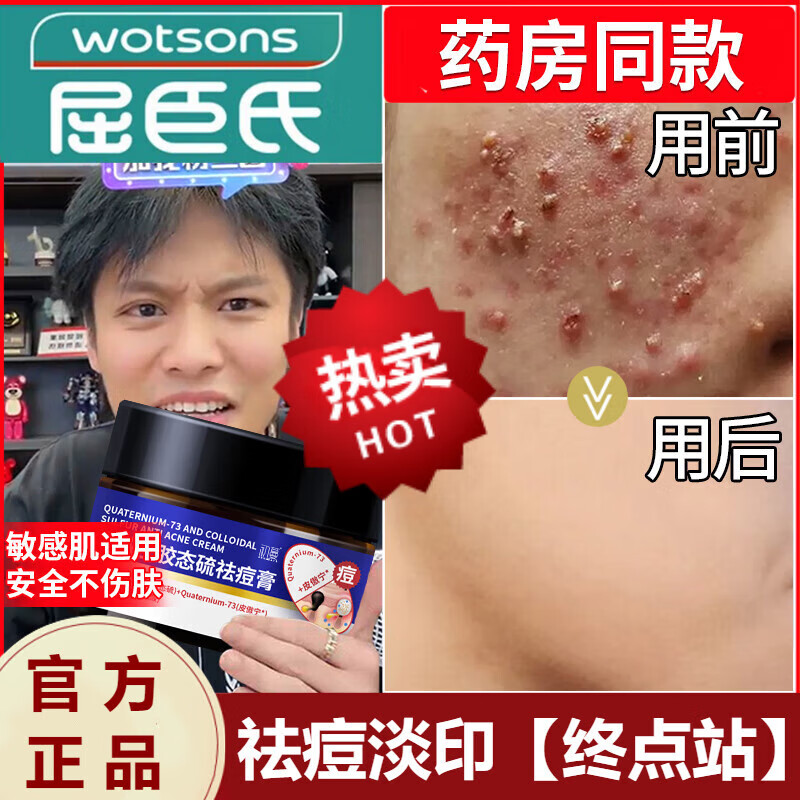 熏姿颜皮傲宁植物祛痘膏中苗药万能霜青春痘痘粉刺修复霜男女用学生