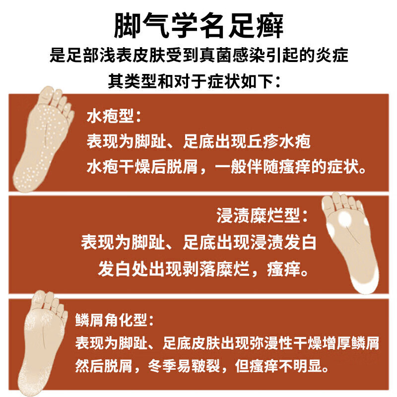 喷剂脚气臭脚狼毒梵贞足浴脚汗足贴要注意哪些质量细节？亲身体验诉说