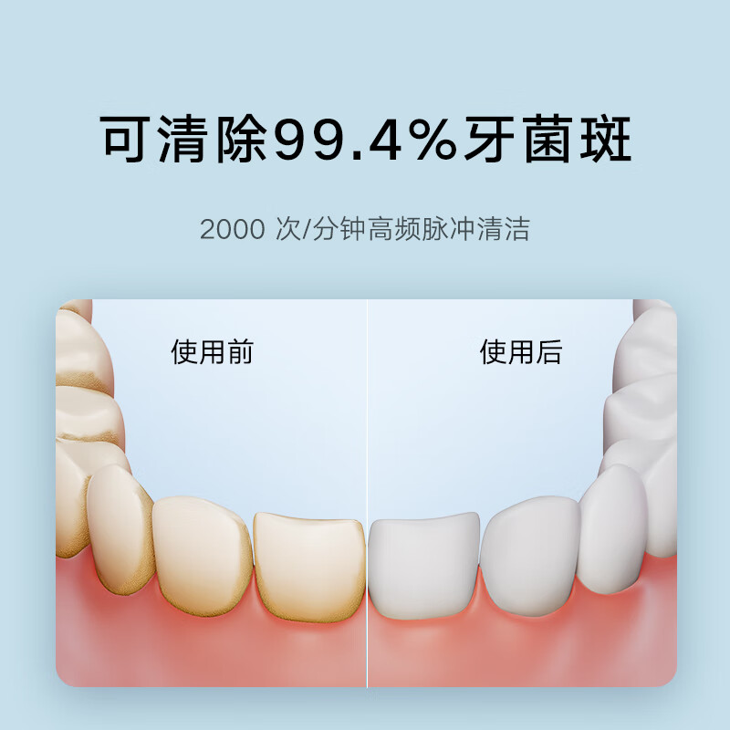 米家小米立式冲牙器洗牙器水牙线 F300薄荷绿 创新散射脉冲 4档模式3种喷嘴 礼物推荐