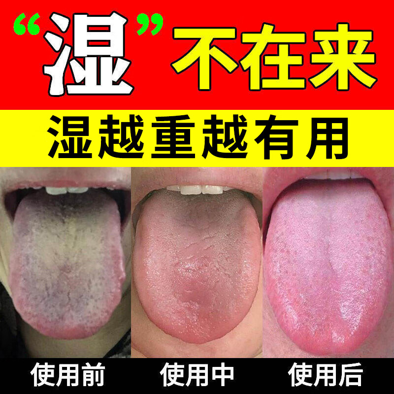 原料五指毛桃茯苓茶脾胃虚寒弱湿气重阴虚肝火旺盛口苦口臭 1盒装