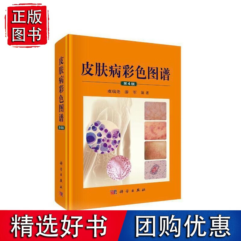 皮肤病彩色图谱（第4版）