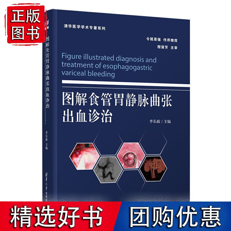 图解食管胃静脉曲张出血诊治