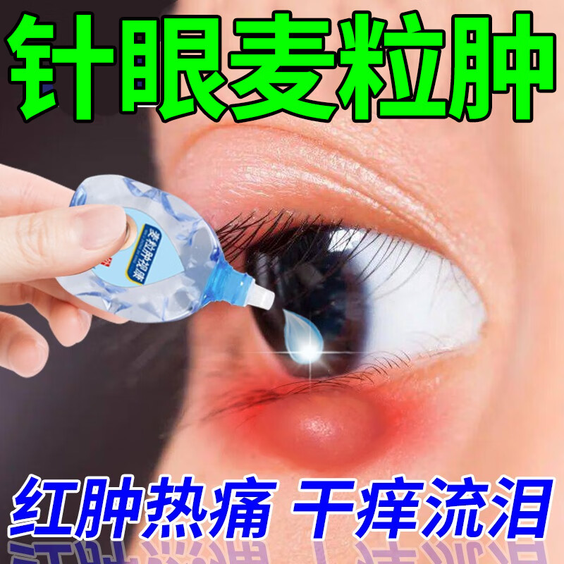 麦粒肿眼药水眼针睑板腺堵塞眼睑红肿痒脓痛视物模糊异物感眼俭炎