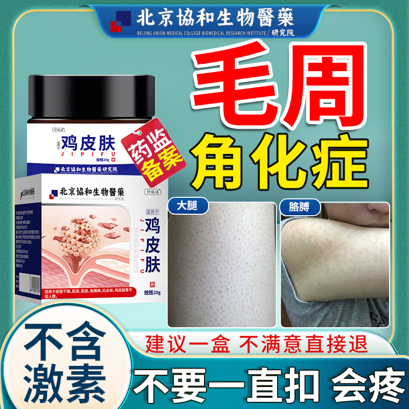 毛周角化专用膏有药监备案鸡皮肤疙瘩毛囊角化症去除神器疙瘩大腿 1盒