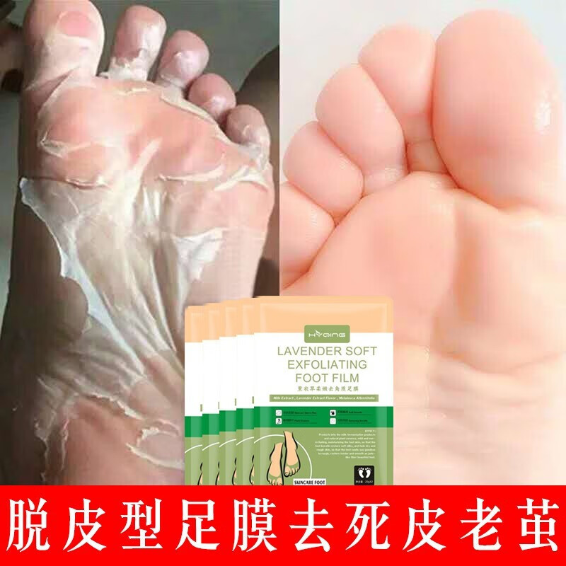 花月情薰衣草足膜5袋脱皮型角质脚后跟老茧死皮汗防干裂防冻滋润嫩肤男女士足部护理补水保湿足膜5袋装 Vogyou 花月情薰衣草足膜5袋脱皮型角质脚后跟老茧死皮汗防干裂防冻滋润嫩肤男女士足部护理补水保湿足膜5袋装 Vogyou
