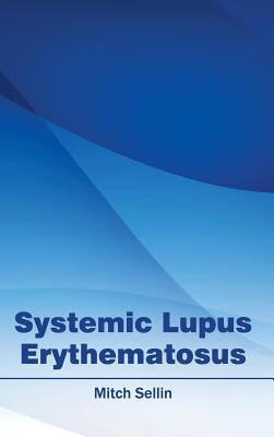systemic,strategically 预订systemic lupus erythematosus