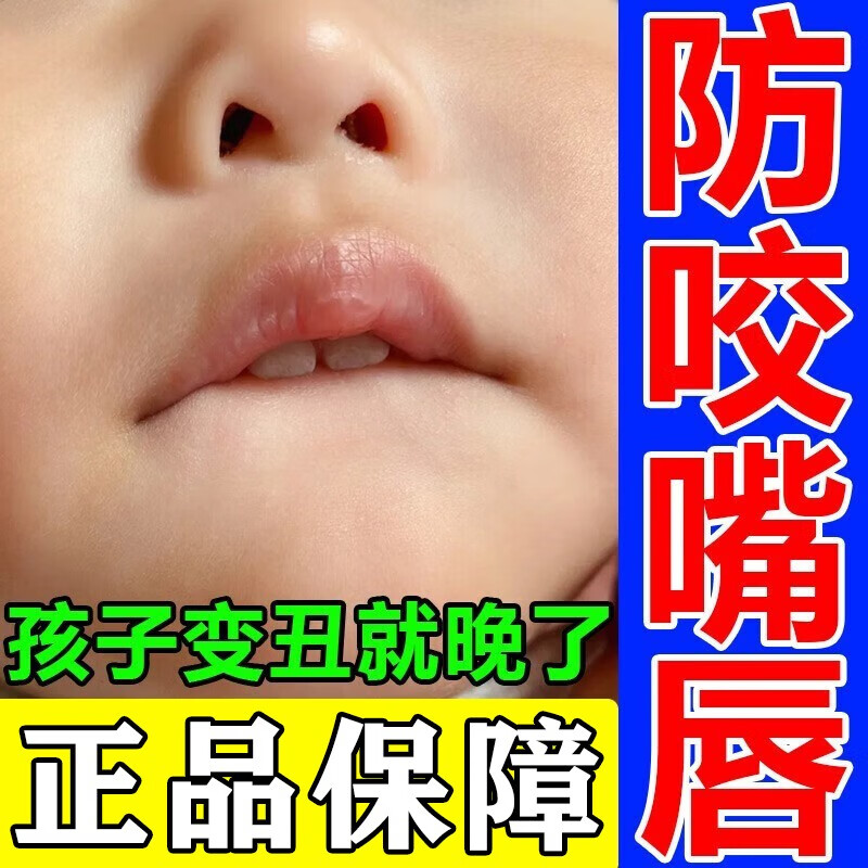 防止小孩咬下嘴唇神器苦瓜水咬嘴唇矫正宝宝婴儿坏习惯 1盒【一抹不咬嘴】