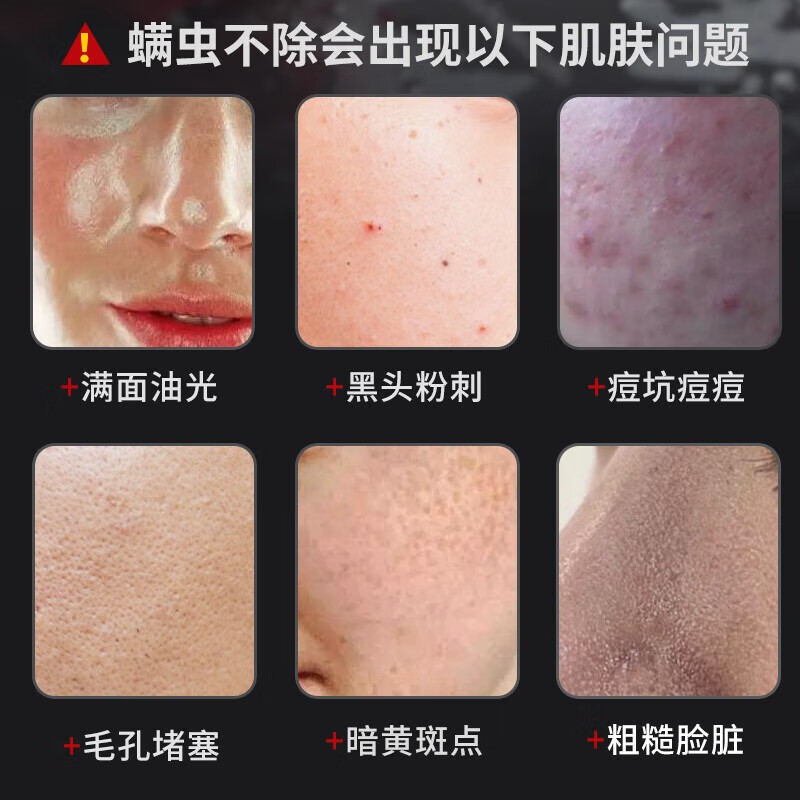 仁和匠心洗面奶除螨虫控油祛痘去黑头缩毛孔氨基酸洗面奶植物复合净颜男女 洁面乳160g