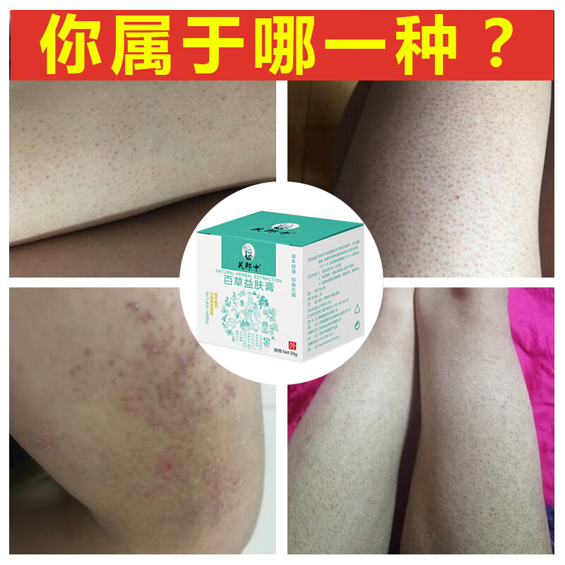 dr sanchez芙郎中毛周角化症肤疙瘩毛囊炎手臂腿部痘痘毛孔堵塞疏通