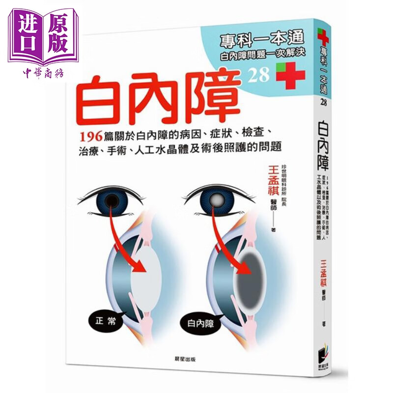 白内障 196篇关于白内障的病因 王孟祺 医疗保健 疾病百科