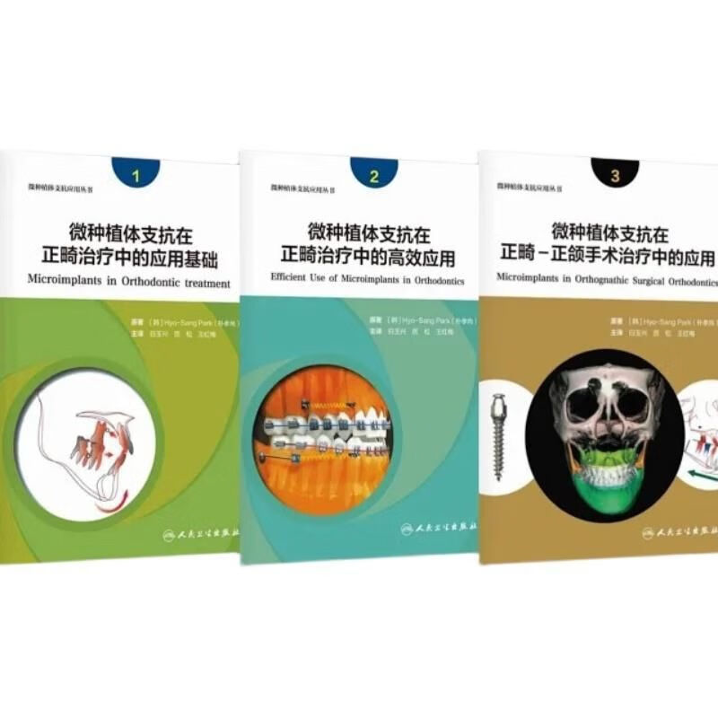 微种植体支抗在正畸治疗中的高效应用123 3本