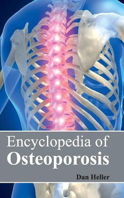 预订Encyclopedia of Osteoporosis