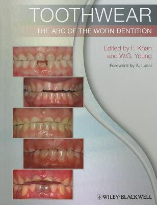 预订 高被引toothwear: the abc of the worn dentition