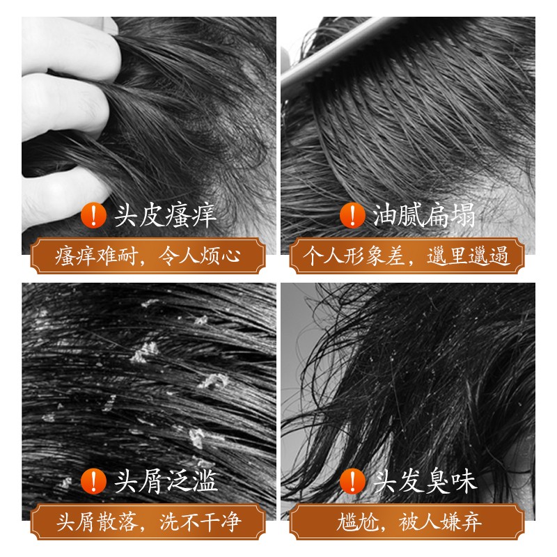 草方百草堂去屑止痒洗发水草方控油蓬松除螨留香去头皮屑头皮痒洗发膏 【去屑控油除螨】祛屑洗发剂320ml