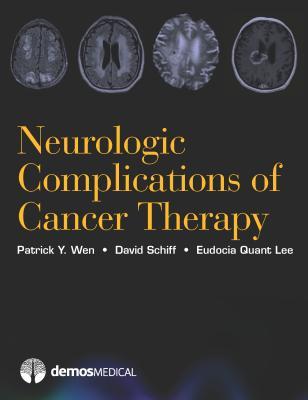 预订 高被引Neurologic Complications of Cancer Therapy