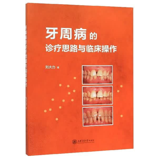 牙周病的诊疗思路与临床操作