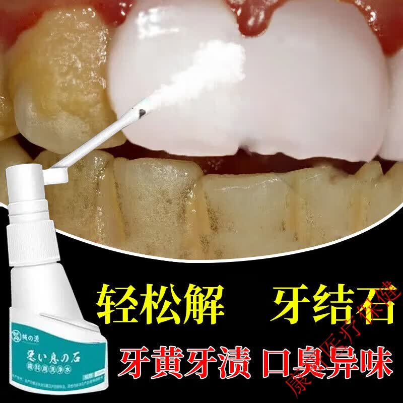 牙结石除器牙黄牙垢牙渍牙齿溶解去1口臭清新口气通用喷剂日本监制 单