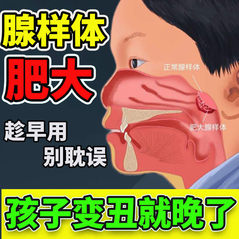 腺样体肥大贴矫正儿童张嘴呼吸睡觉打呼噜小儿鼻塞鼻