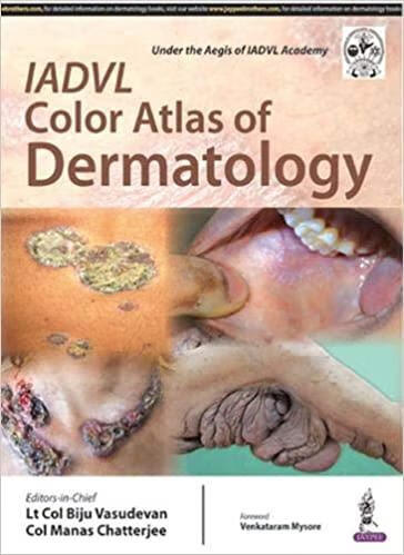 预订IADVL Color Atlas of Dermatology