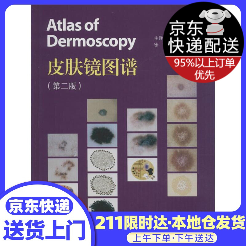 皮肤镜图谱（第二版）