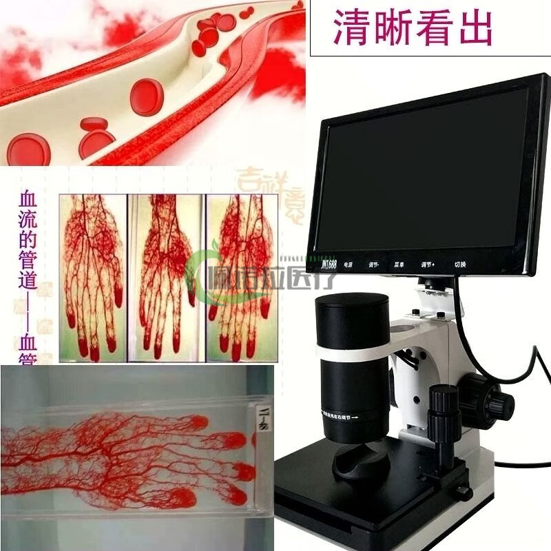 优囹便携式血流速度检测 微循环检测仪高清显微镜甲襞可视血流速清晰