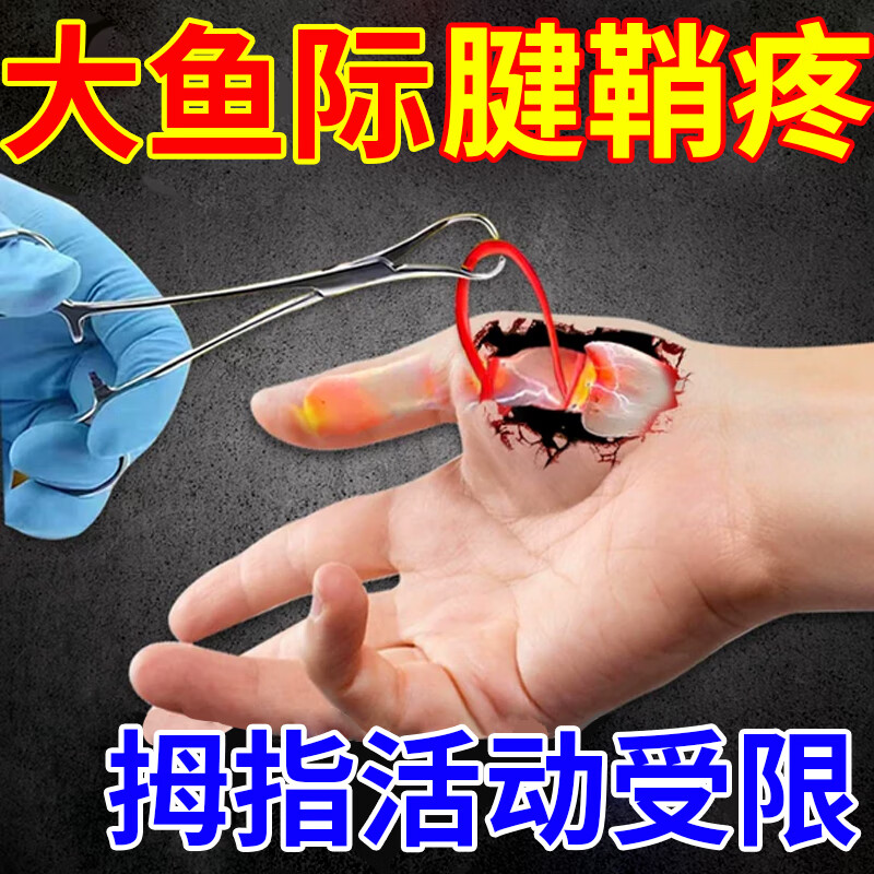 剂大鱼际手指关节疼痛肿胀可搭配膏贴gu 单盒试用装针对大鱼际腱鞘炎