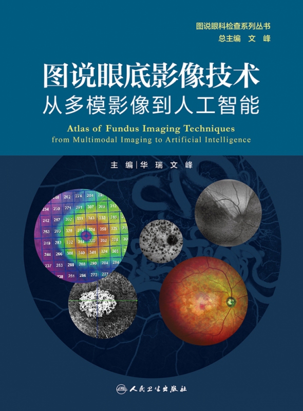 图说眼底影像技术 从多模影像到人工智能 （图说眼科检查系列）