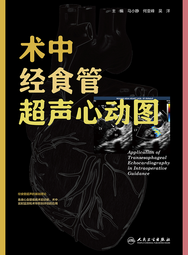 术中经食管超声心动图
