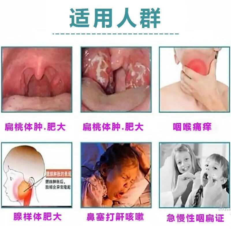 腺样体肥大贴矫正儿童张嘴呼吸闭口睡觉打呼噜小儿鼻塞鼻涕腺样体肿大不通气面容矫正调理保健贴 1盒【儿童腺样体肥大贴】