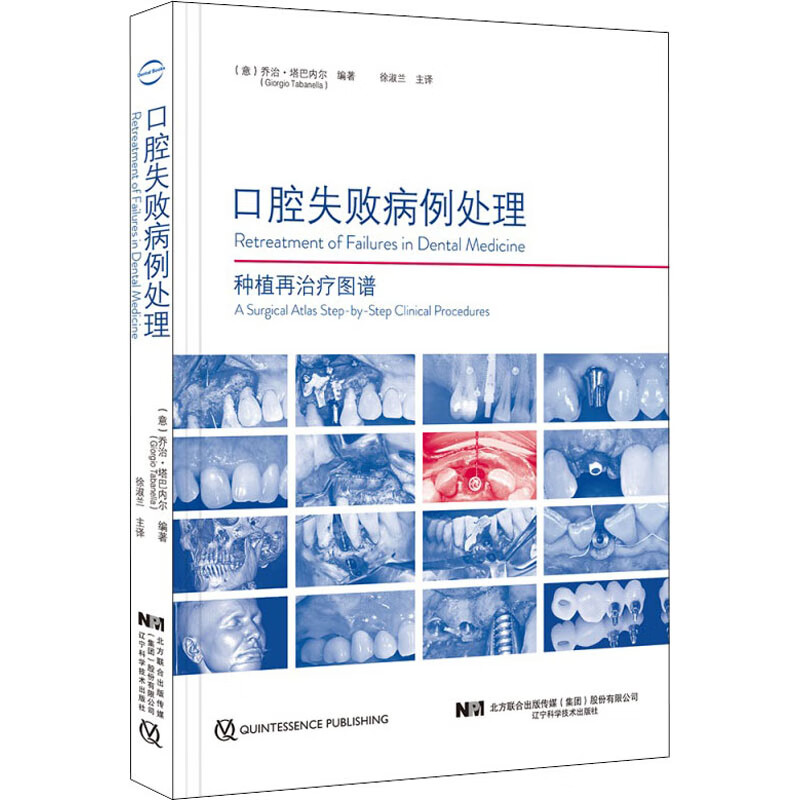 口腔失败病例处理
