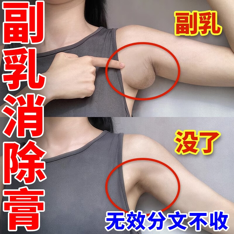 【最快7天收副乳】副乳消除神器去副乳淋巴结节腋下赘肉贴耳后淋巴肿大疏通排毒消散膏贴 JY 3盒 买2送1【试用疗程】单侧推荐