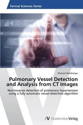预订Pulmonary Vessel Detection and Analysis from CT