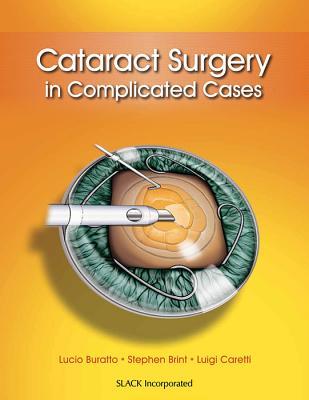 预订 高被引cataract surgery in complicated cases