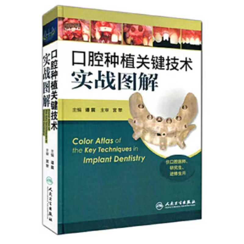 口腔种植关键实战图解谭震著