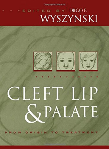 预订 cleft lip and palate