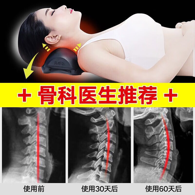 尚合元 颈椎病专用枕头曲度变直反弓加热拉伸牵引劲锥热敷圆柱护颈枕 热疗版黑色