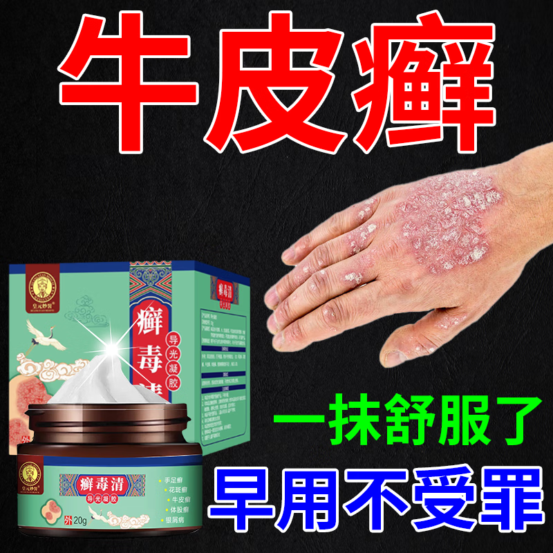 牛i皮癣专i用药顽固牛i皮癣银屑药病大腿内侧皮肤瘙痒潮湿头疹股 一瓶