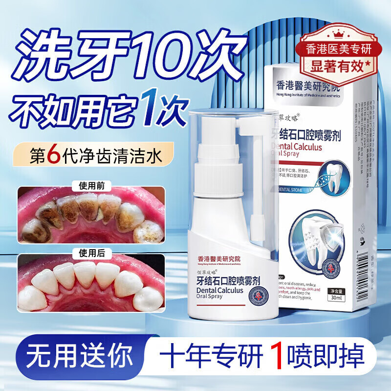 SKIG家庭清潔清掃水口腔噴劑清新口臭噴霧結(jié)石漱口水去油去污清潔用品 1瓶