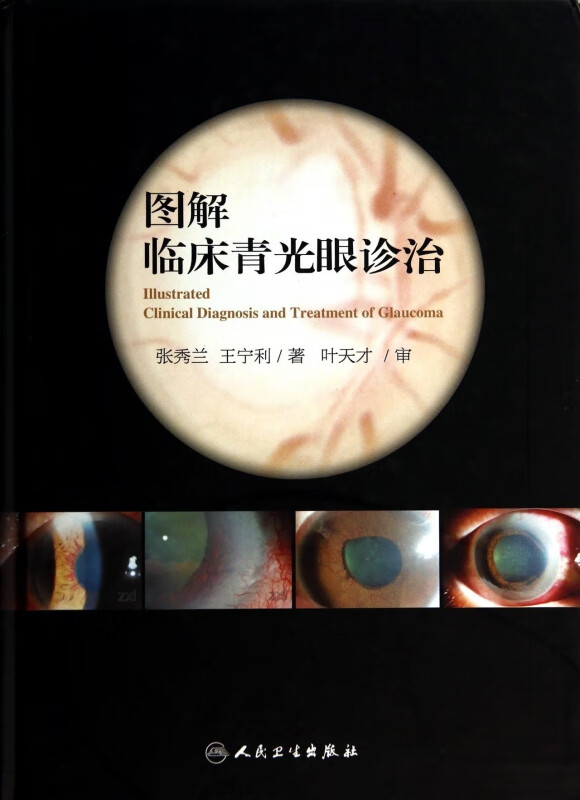 图解临床青光眼诊治(精)
