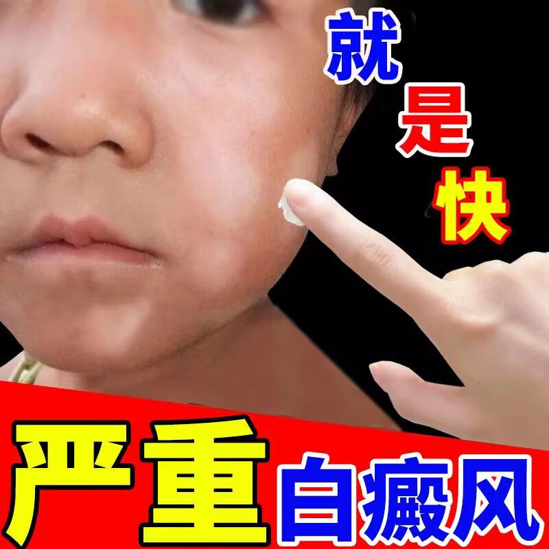 仙怀堂补骨白l斑抑菌膏白殿风软膏祛汗l斑花l斑补骨脂白白癜风斑乳膏