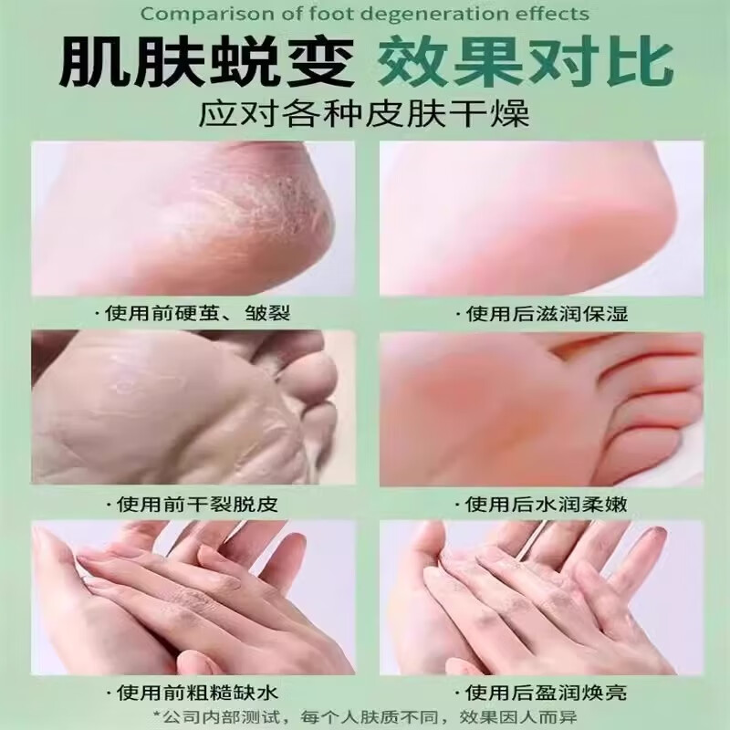 尔棠南非小绿膏破裂膏进口原装防手脚后脚跟干裂秋冬男女皮肤干裂 1罐 75g 官方认证