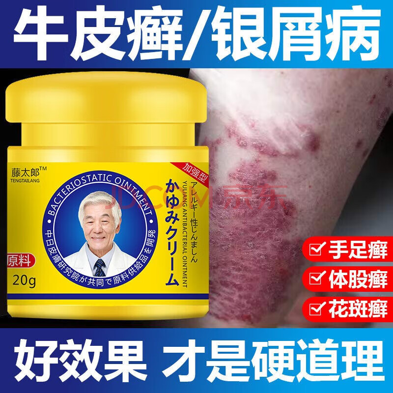 alles japan皮肤瘙痒痒膏皮肤消毒护理湿l疹皮l炎头体l癣手足l藓抑菌