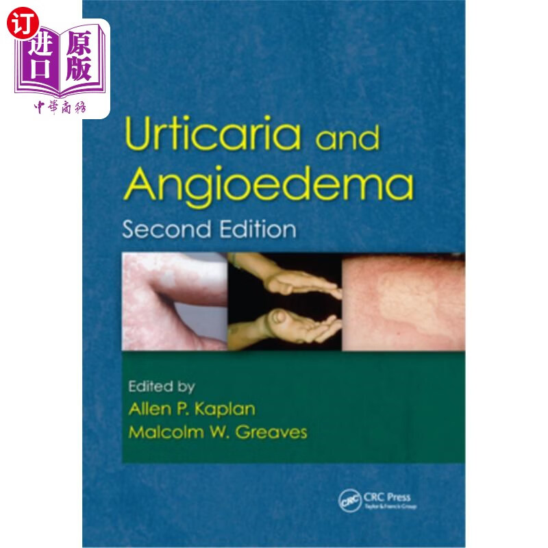 海外直订医药图书urticaria and angioedema 荨麻疹和血管性水肿